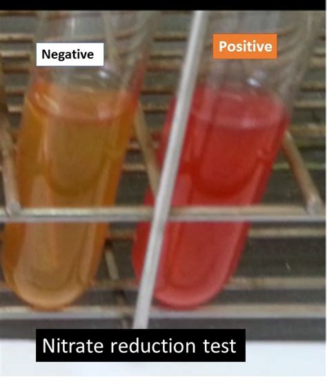 nitrate reduction test positive|Nitrate Reduction Test .